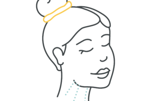 Line drawing of woman with hair up representing where the injection spots are for the neck lift. The dots are under the chin and down the neck