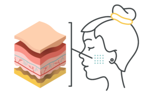 Graphic showing layers of the skin along with a line graphic representing a face