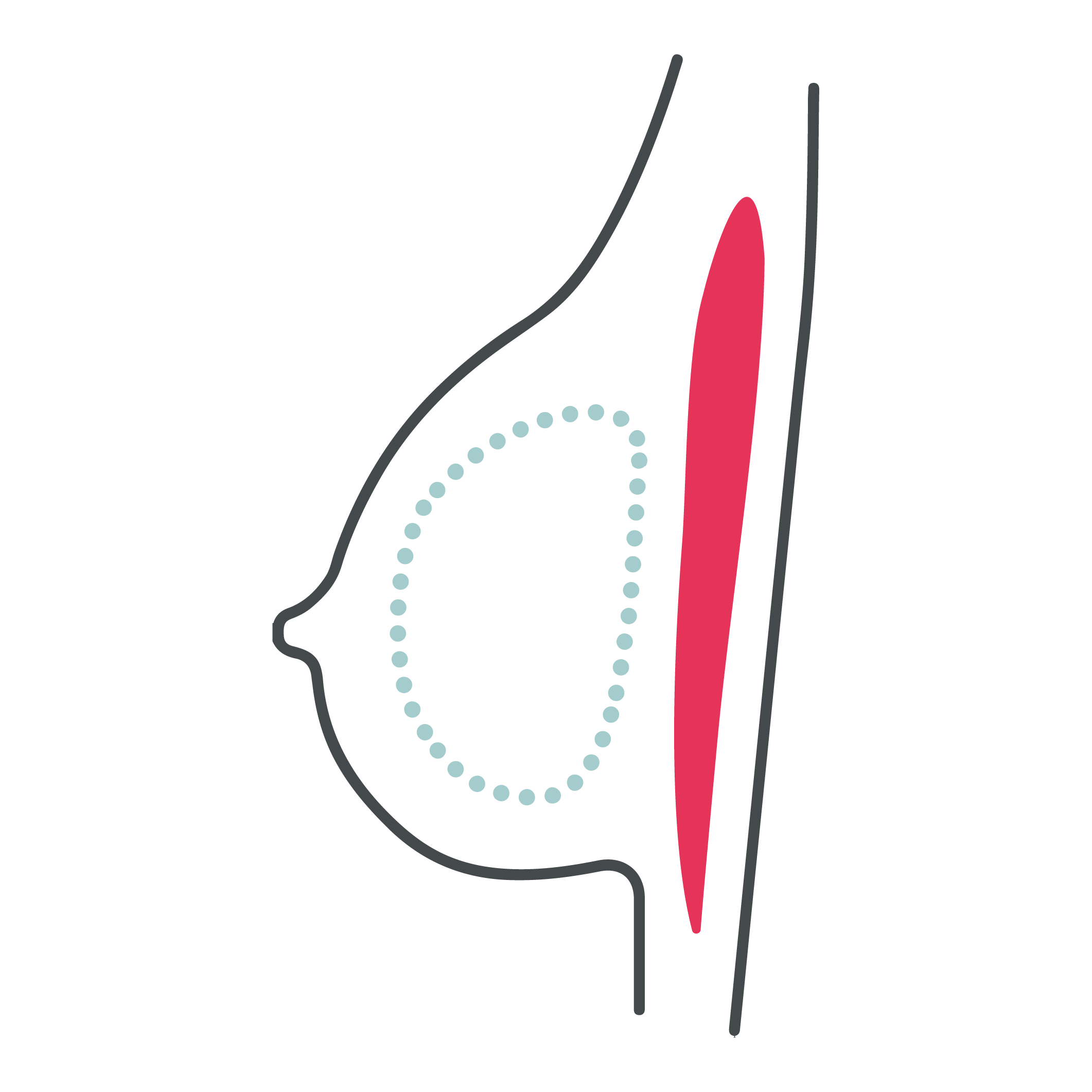 Preservé final result line graphic