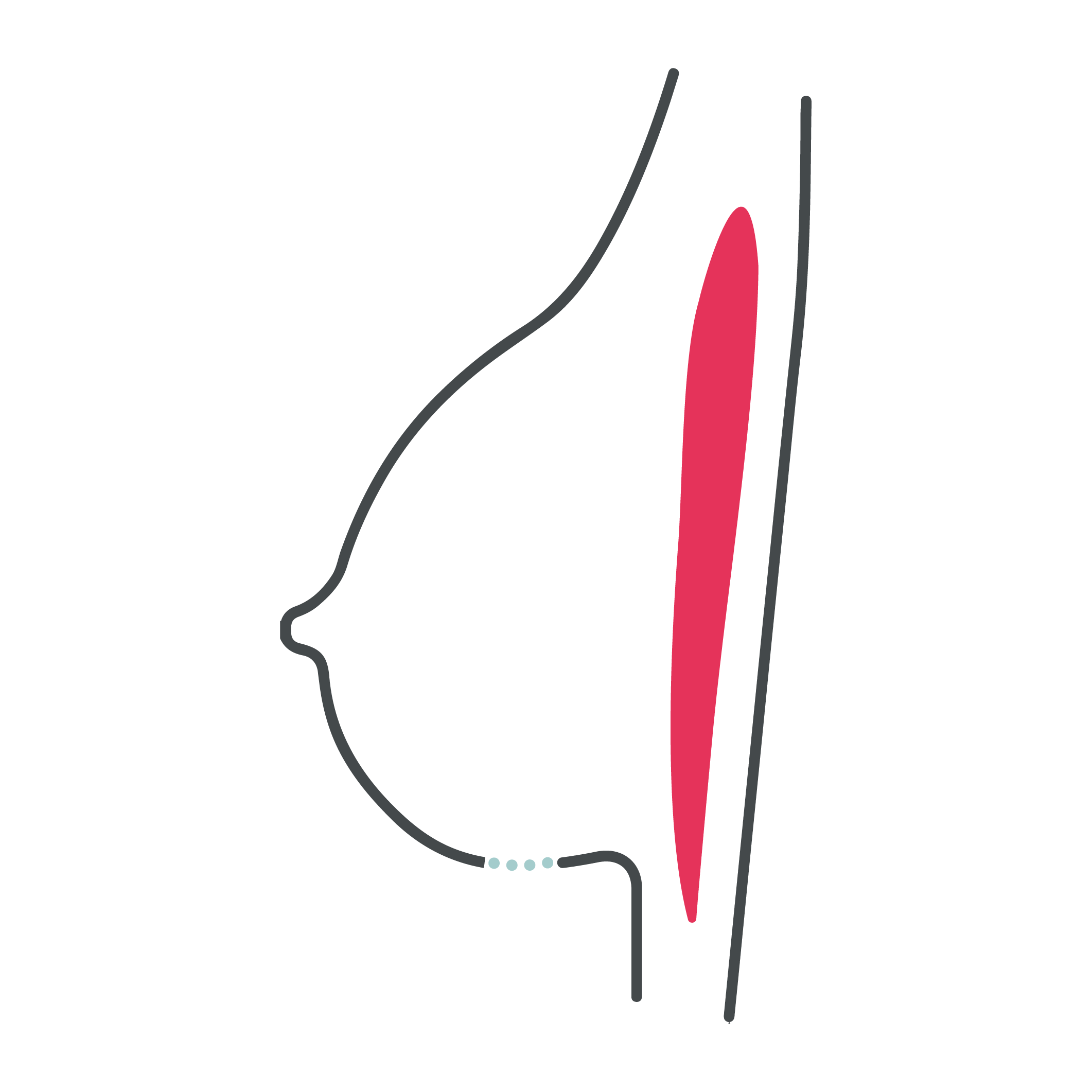 Preservé incision line graphic